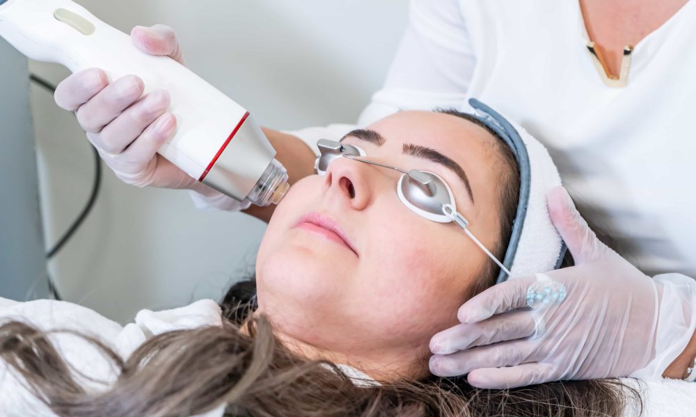 What Are The Benefits Of Radiofrequency Microneedling?